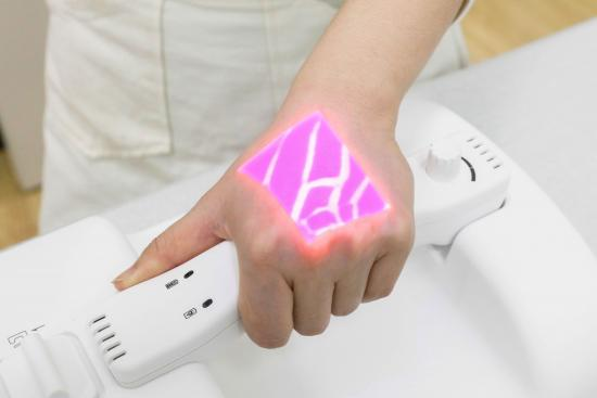 Vein Finder manufacturer