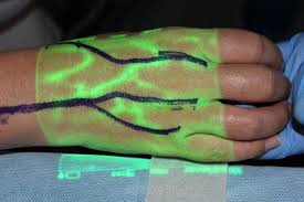 ¿Cuáles son las investigaciones extranjeras y los avances tecnológicos relevantes con respecto a Vein Finder?