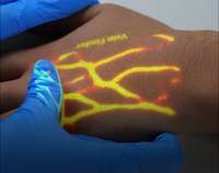 Aplicaciones clínicas de Vein Finder