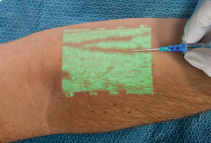 ¿Cómo podemos evitar la tensión de los pacientes al utilizar un dispositivo localizador de venas?