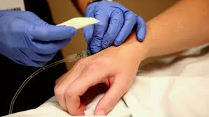 ¿Cómo evaluar la efectividad clínica antes de comprar un detector de venas?