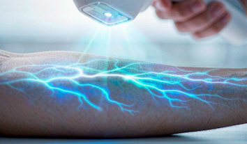 Guía de compra del detector de venas: Reducción de costos de acceso venoso difícil | ZD Medical