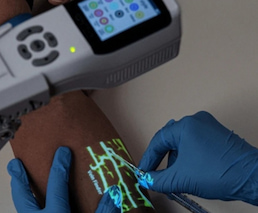 ¿Cómo pueden los dispositivos portátiles de imágenes venosas ayudar en la recolección de sangre a domicilio?