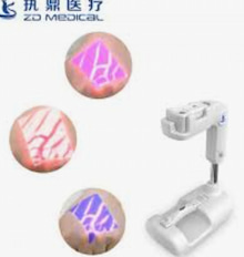 ¿Cuáles son los cuatro puntos clave a los que debe prestar atención Vein Finder?