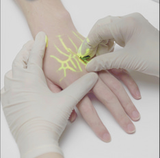 Últimas investigaciones y tendencias en tecnología Vein Finder
