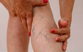 Oportunidades en los mercados emergentes: ¿Cuáles son los potenciales de aplicación del detector de venas en la atención primaria de salud en los países en desarrollo?