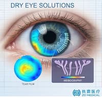 Avanzando en el cuidado de la superficie ocular con la solución integrada para el ojo seco de ZD Medical